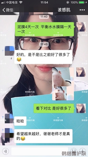 粉刺、痘痘、痘印、統統解決啦！祛痘去粉刺就是這么簡單！