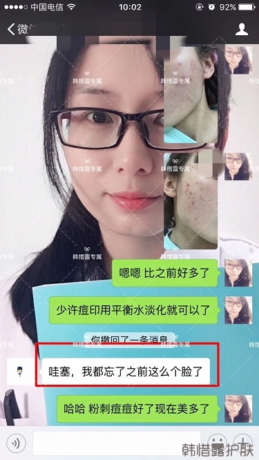 痘痘好了皮膚美麗，不想再記起曾經(jīng)滿臉痘痘的自己！
