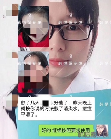 什么產(chǎn)品祛痘效果好？有什么祛痘效果好的產(chǎn)品？