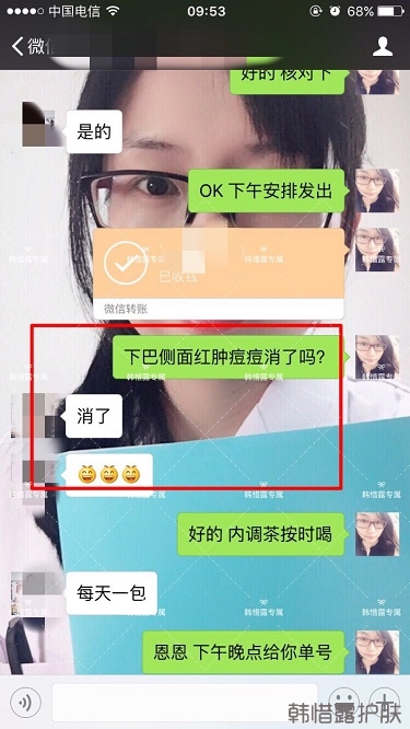 膿包結節發硬痘痘全消了，帥哥開心的來反饋了！