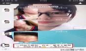 下巴長痘怎么辦？看這里徹底去掉痘痘，不再長痘了！